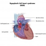 Biomedicine Update: An Innovation That Will Change The Way We Treat Heart Disease