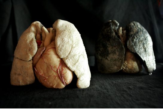 lungs_good_and_bad.jpg.size.xxlarge.letterbox