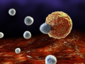 chronic-lymphocytic-leukemia-cancer-cell-image2