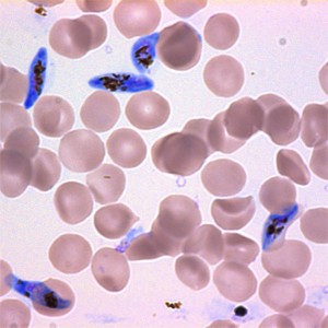 plasmodium falciparum