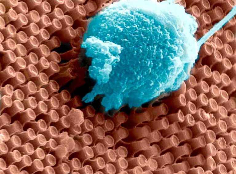 New Implant Could Reverse Blindness Caused by Macular Degeneration and Retinitis Pigmentosa