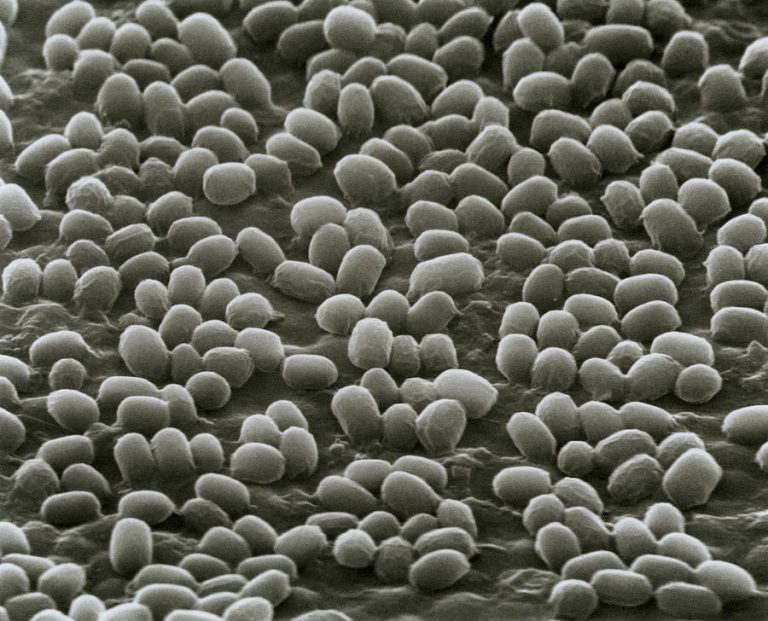 Diseases Trapped in Permafrost and Climate Change – Is There a Problem?