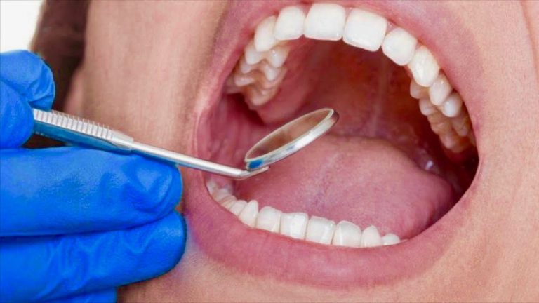 Dentists May Soon Be Able to Regrow Tooth Enamel