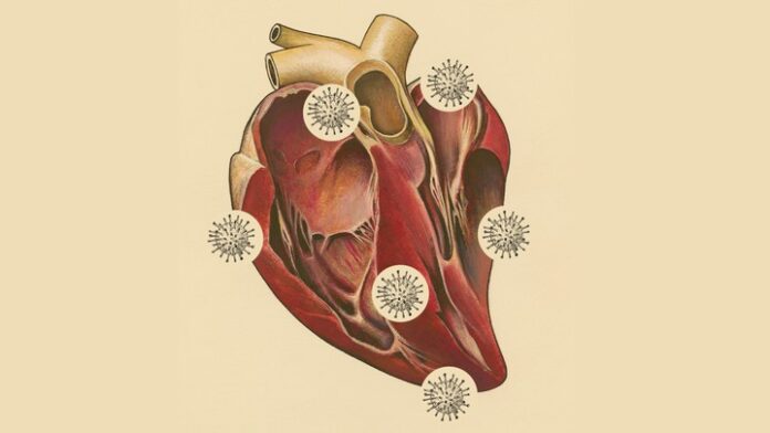 https://www.theatlantic.com/health/archive/2020/09/covid-19-heart-pandemic-coronavirus-myocarditis/616420/